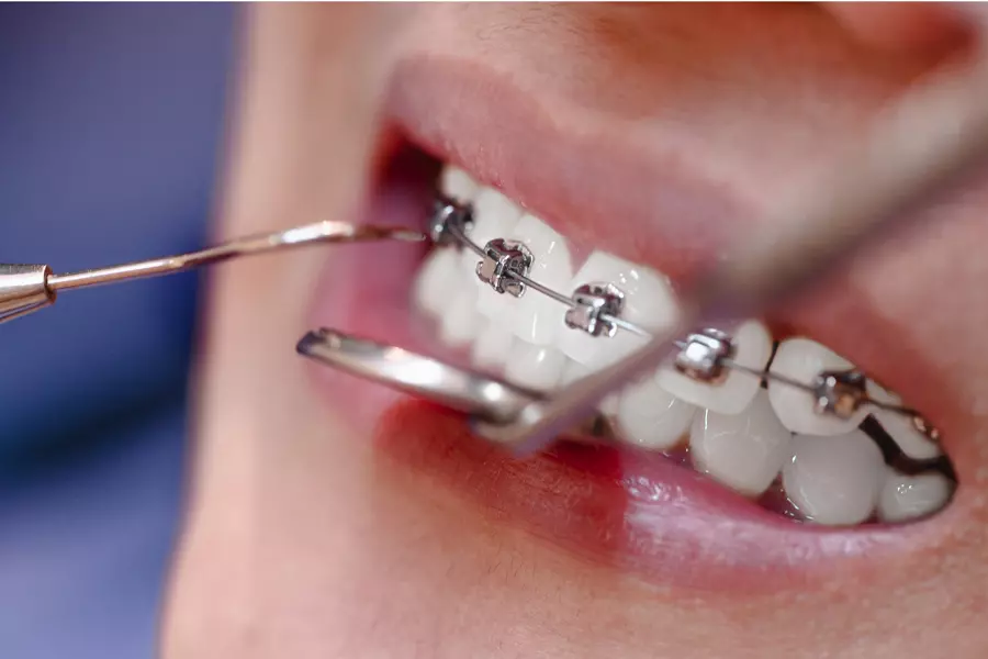 Restorative Dentistry (Dummy)