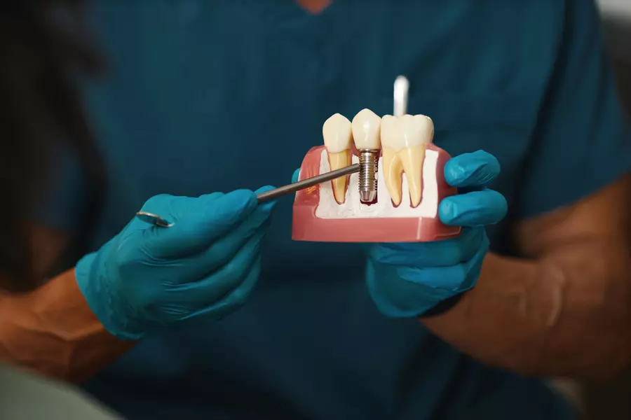 Dental Filling (Dummy)