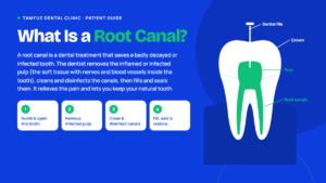 what is Root Canal