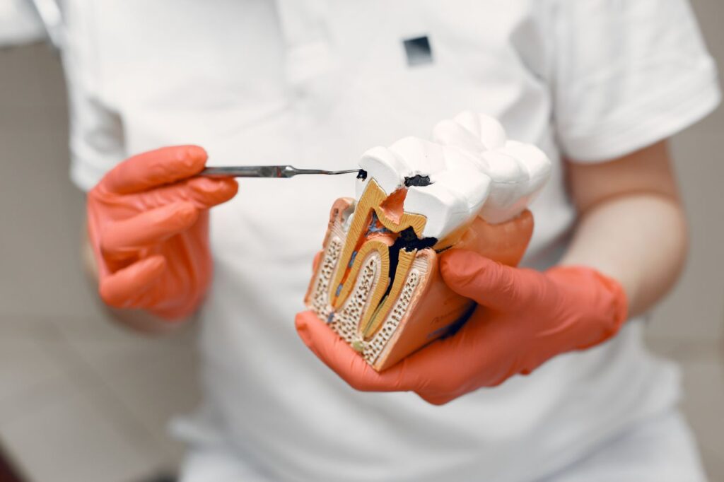 When Do You Need a Root Canal Treatment?