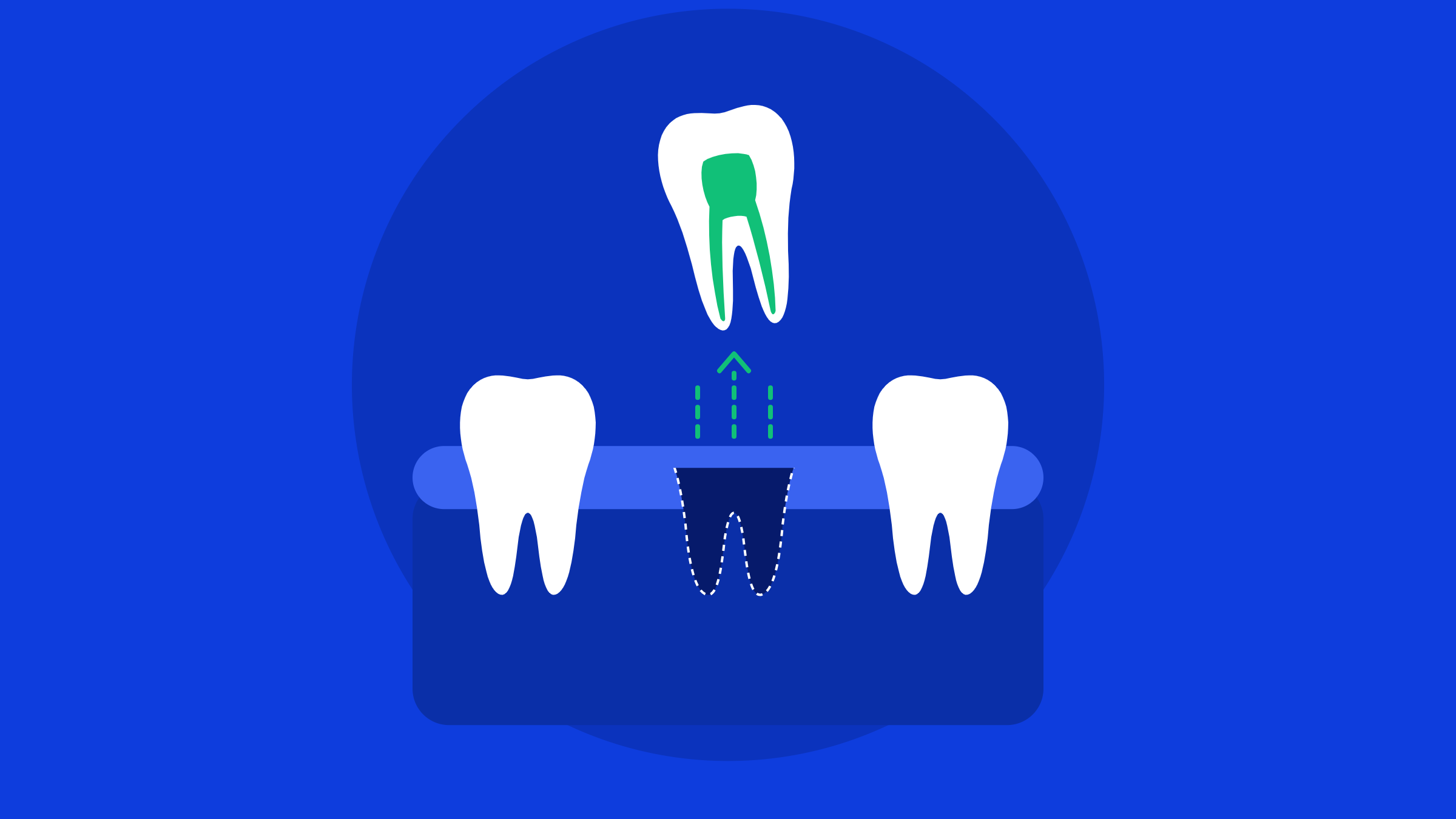 tooth extraction in Salalah at Tamyuz Dental Clinic